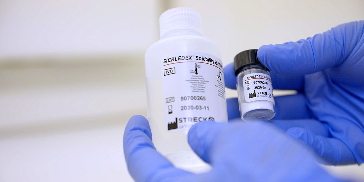 SICKLEDEX sickle solubility test kit