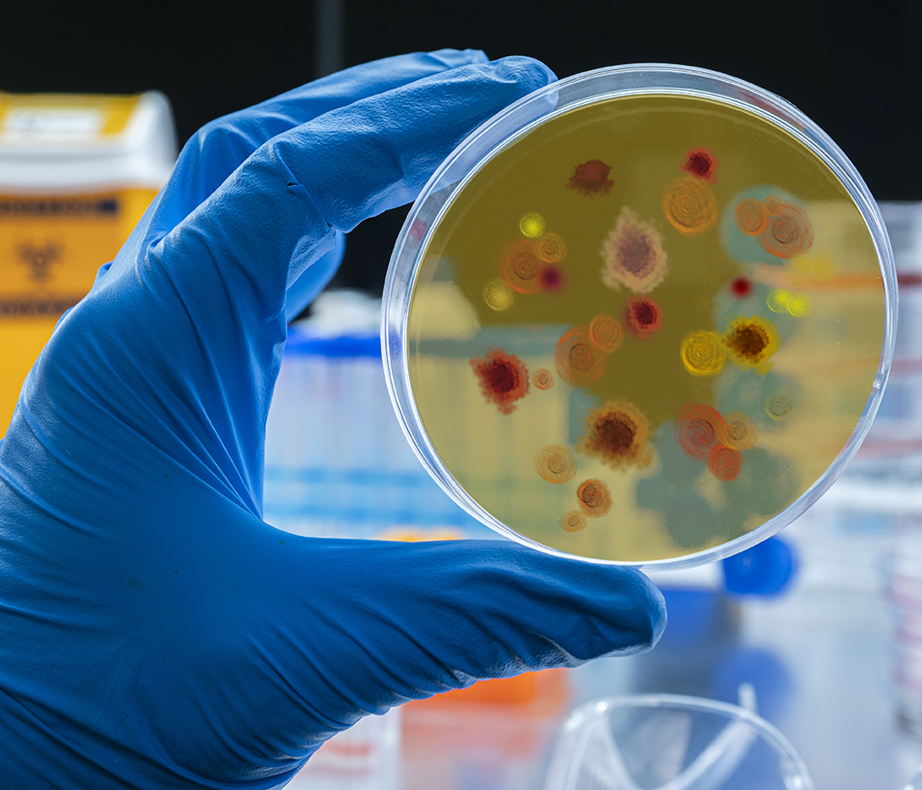 Scientist examines malaria virus on petri dish in laboratory